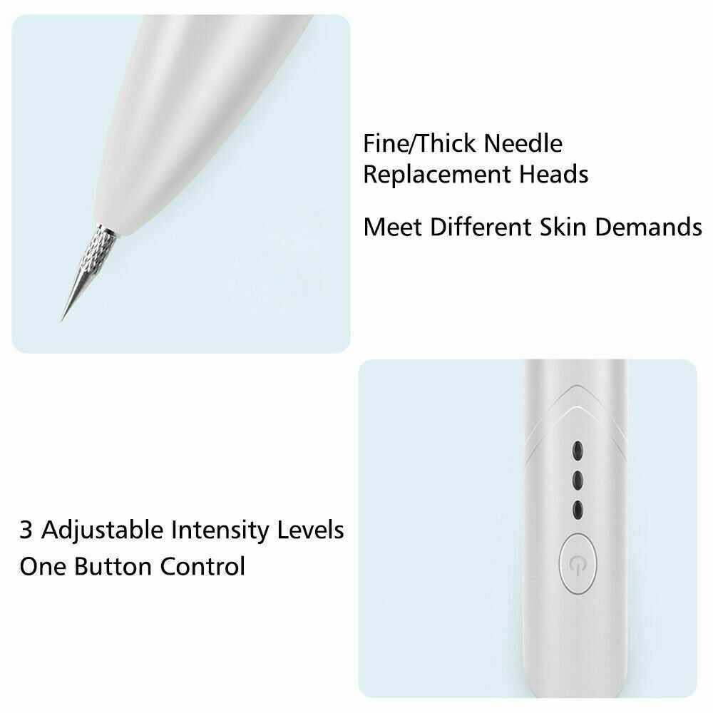 Ion Laser Freckle, Skin Mole Dark Spot Remover
